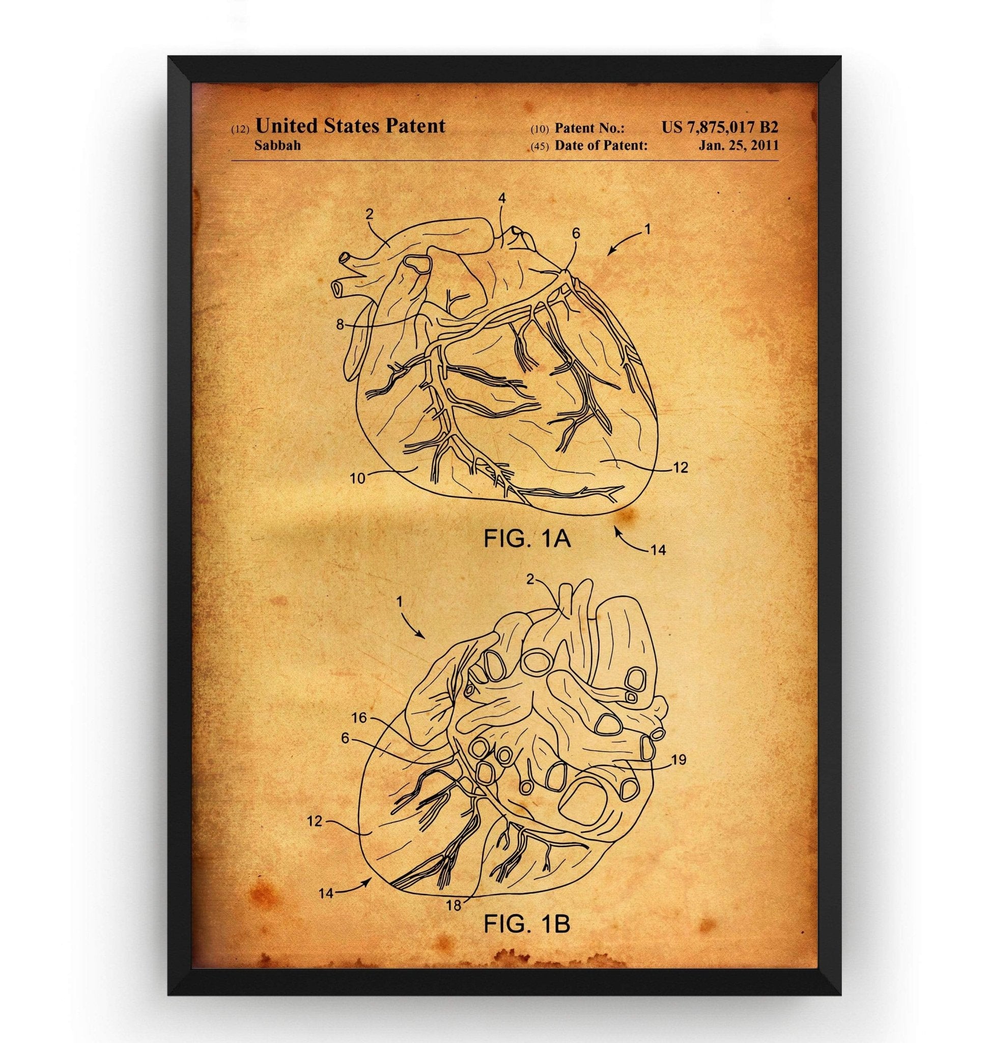 Anatomical Heart Patent Print - Magic Posters