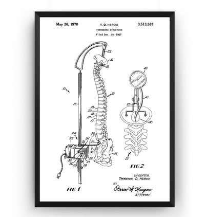 Vertebrae Structure 1970 Patent Print - Magic Posters