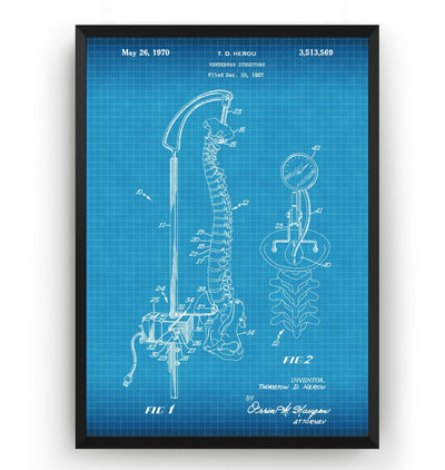 Vertebrae Structure 1970 Patent Print - Magic Posters