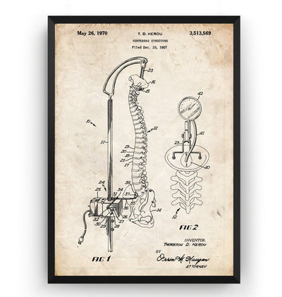 Vertebrae Structure 1970 Patent Print - Magic Posters