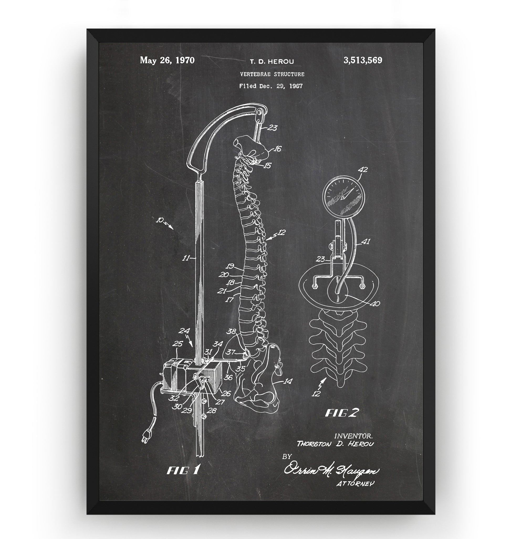 Vertebrae Structure 1970 Patent Print - Magic Posters