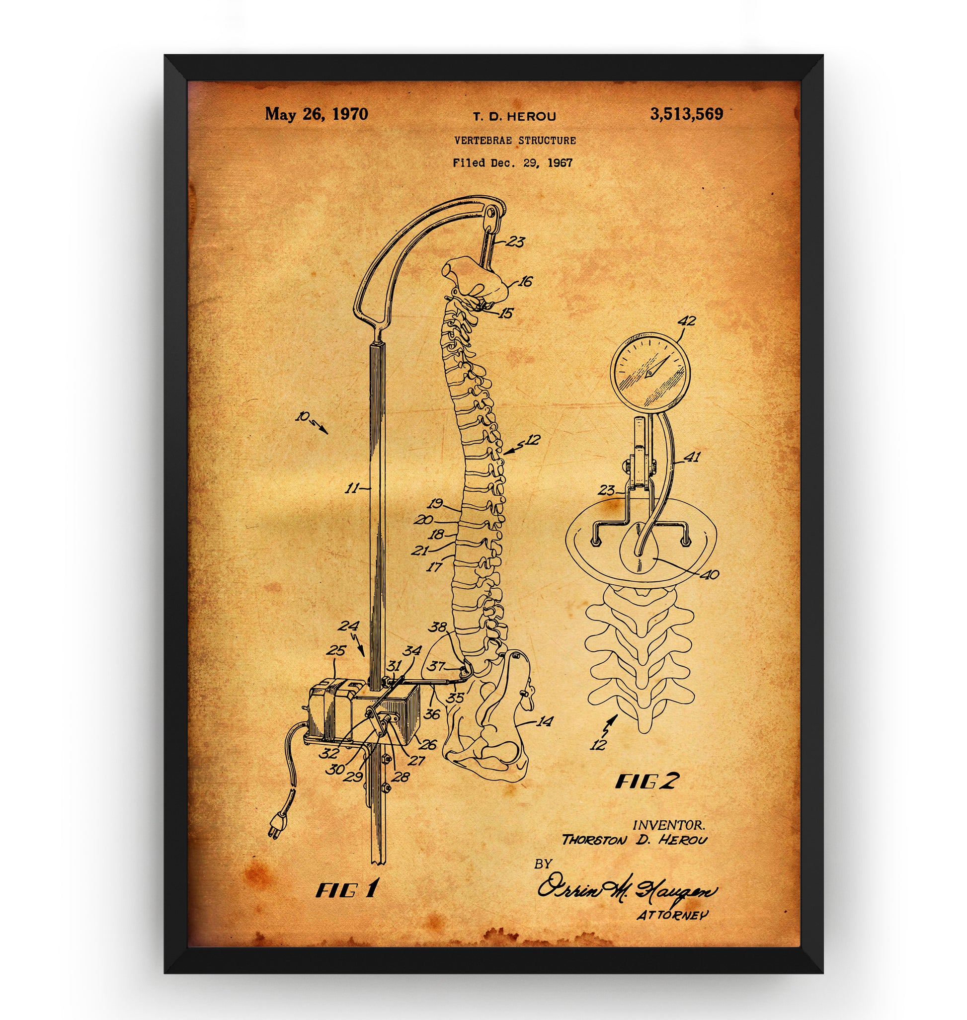 Vertebrae Structure 1970 Patent Print - Magic Posters