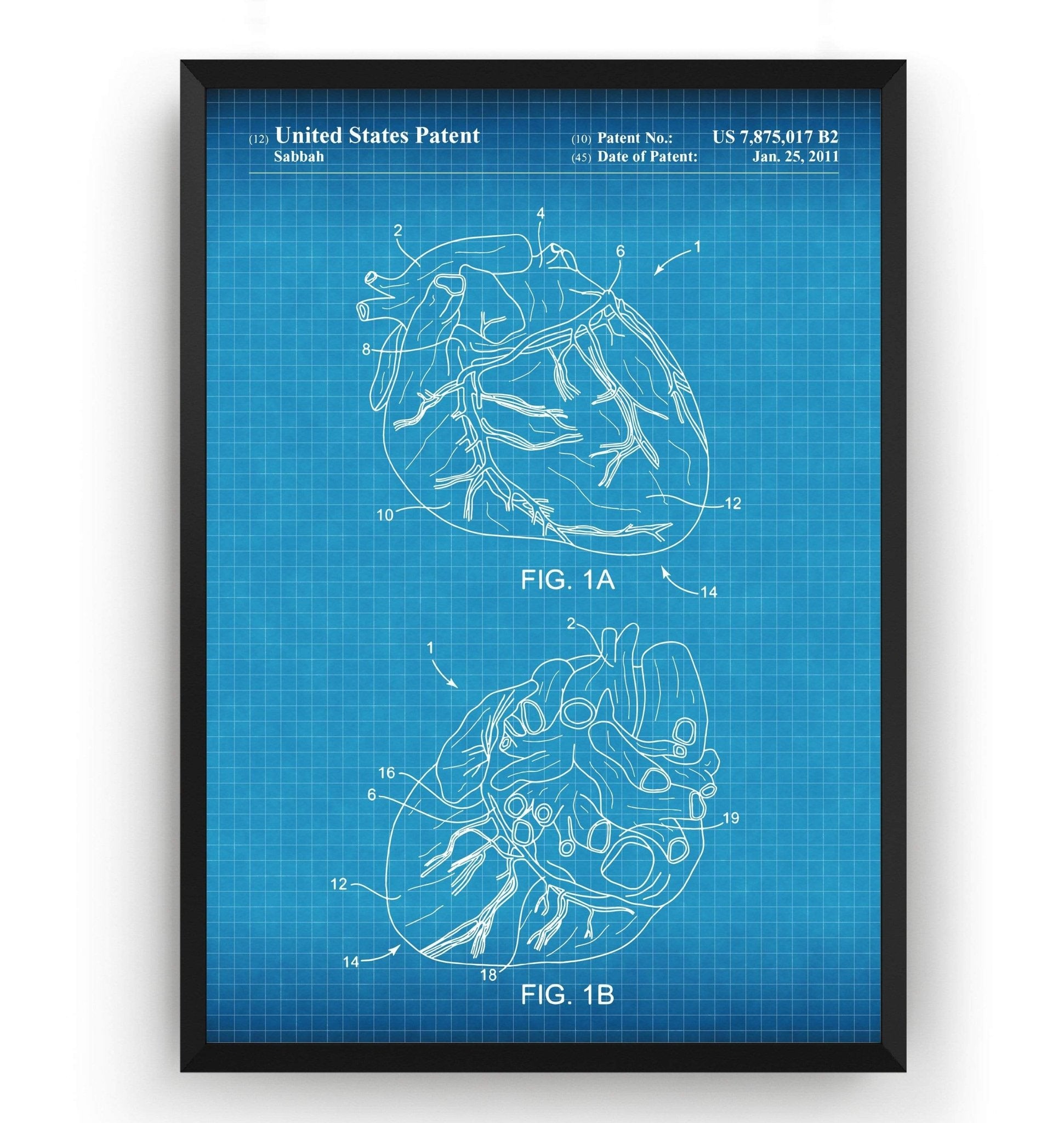 Anatomical Heart Patent Print - Magic Posters