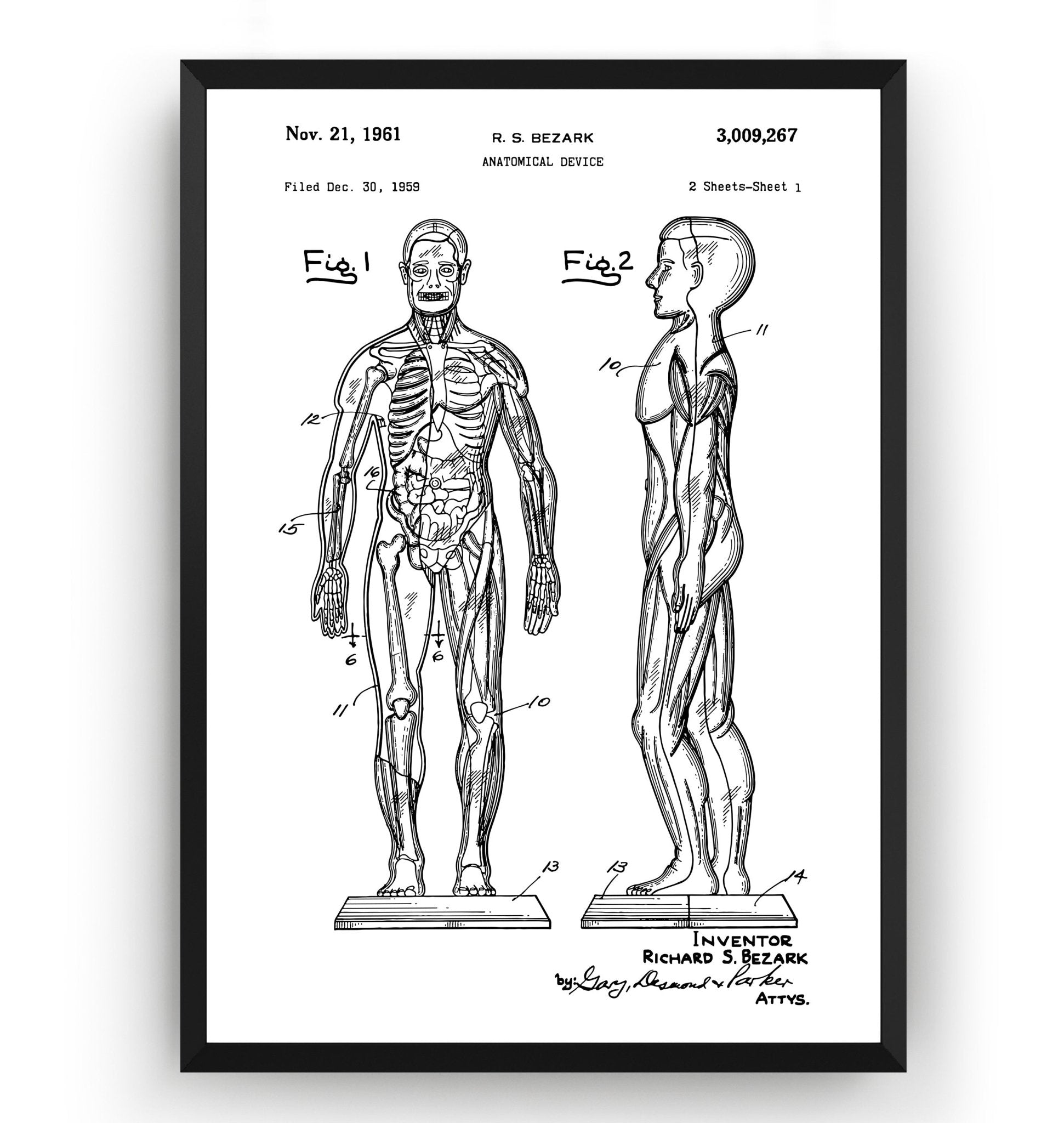 Anatomical Muscle 1961 Patent Print - Magic Posters