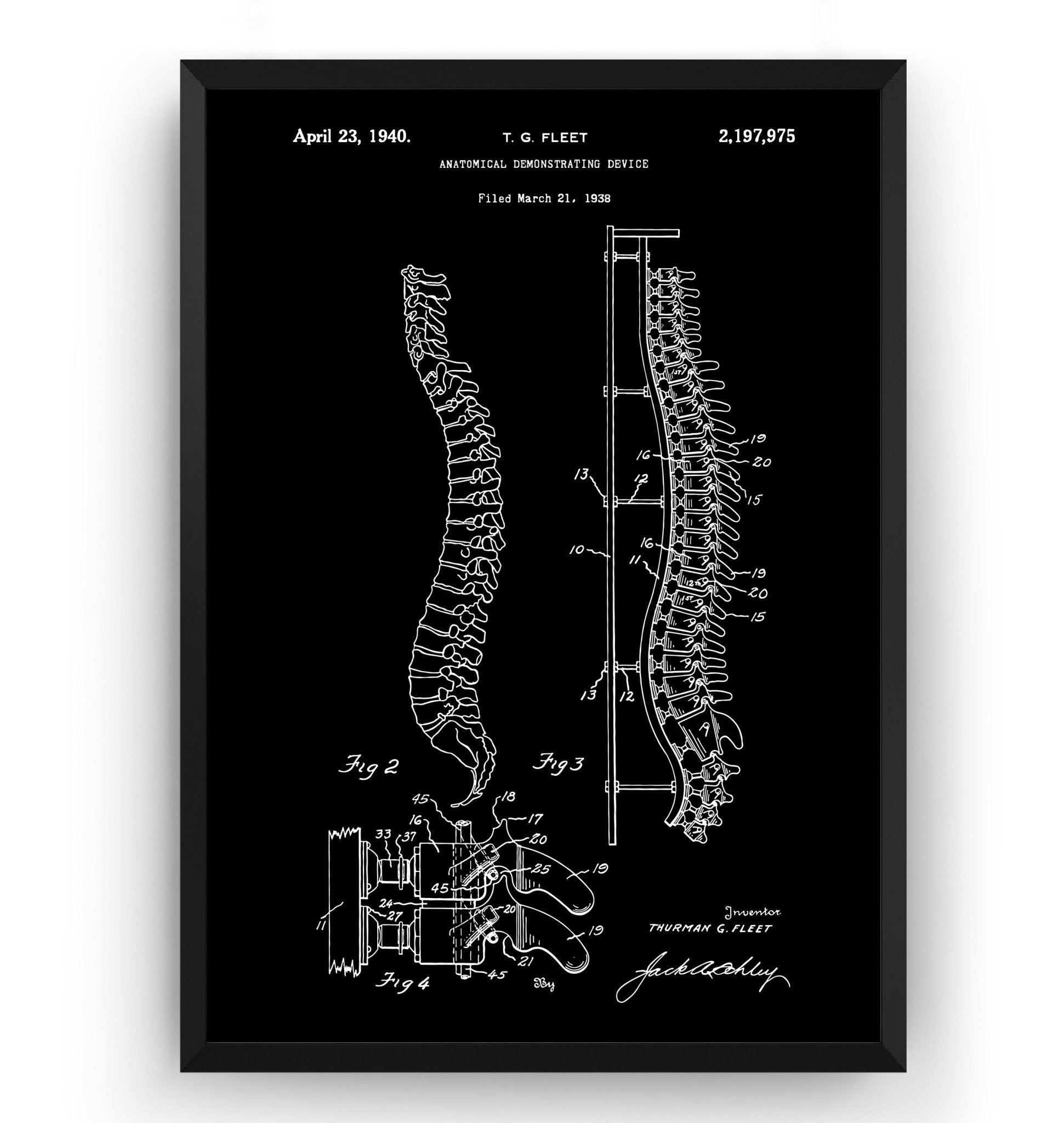 Anatomical Spine Demonstrating Device 1940 Patent Print - Magic Posters